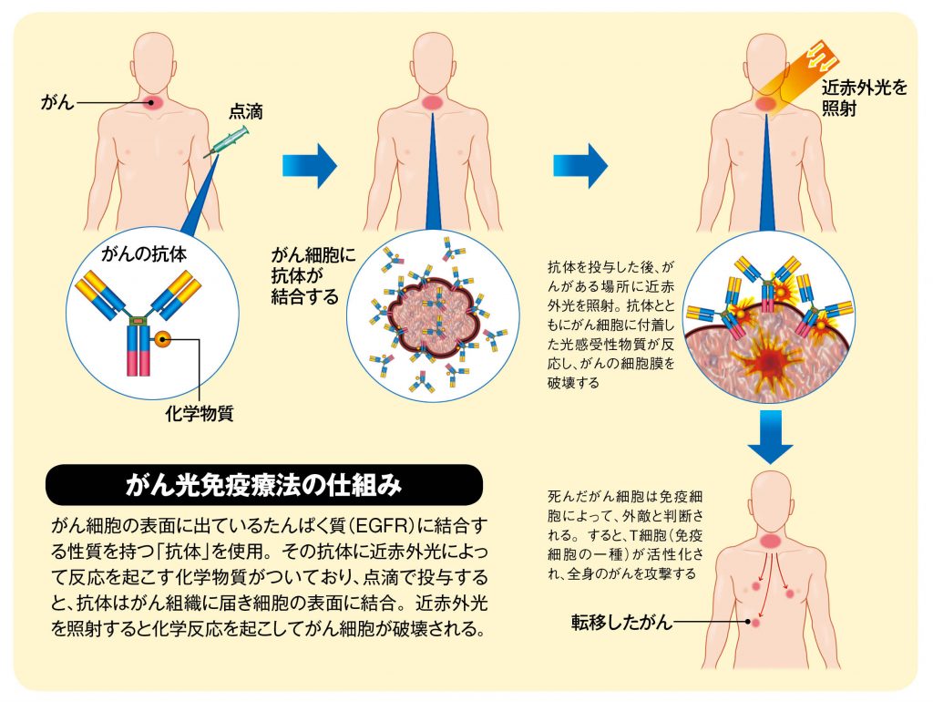 療法 光 免疫